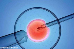 中国靠谱借卵代孕公司