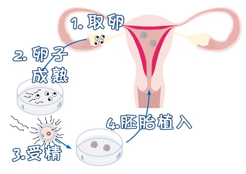 胚胎培養